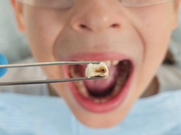 Best Emergency Dental Services for Seniors in Coudersport, PA