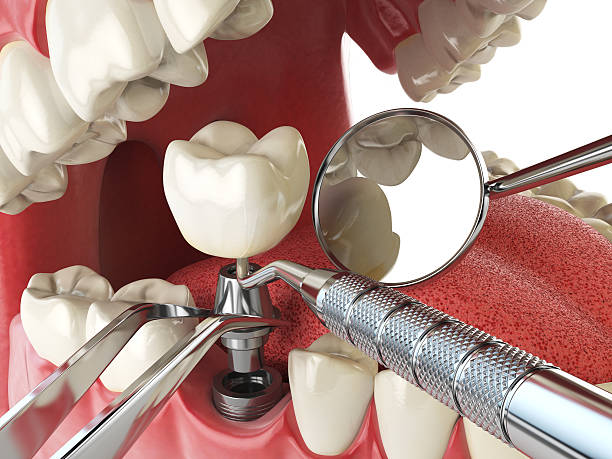 Best Emergency Dental Care for Abscessed Tooth in Coudersport, PA
