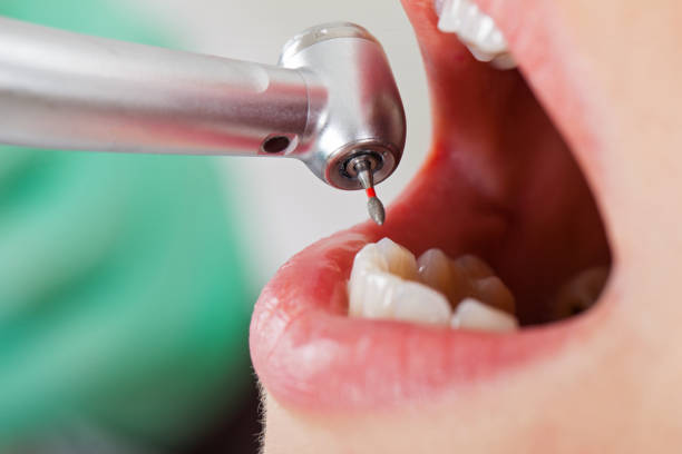 Best Weekend Emergency Dentist in Coudersport, PA